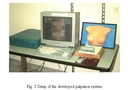Finger Tracking for Breast Palpation Quantification With Stereo Color Cameras